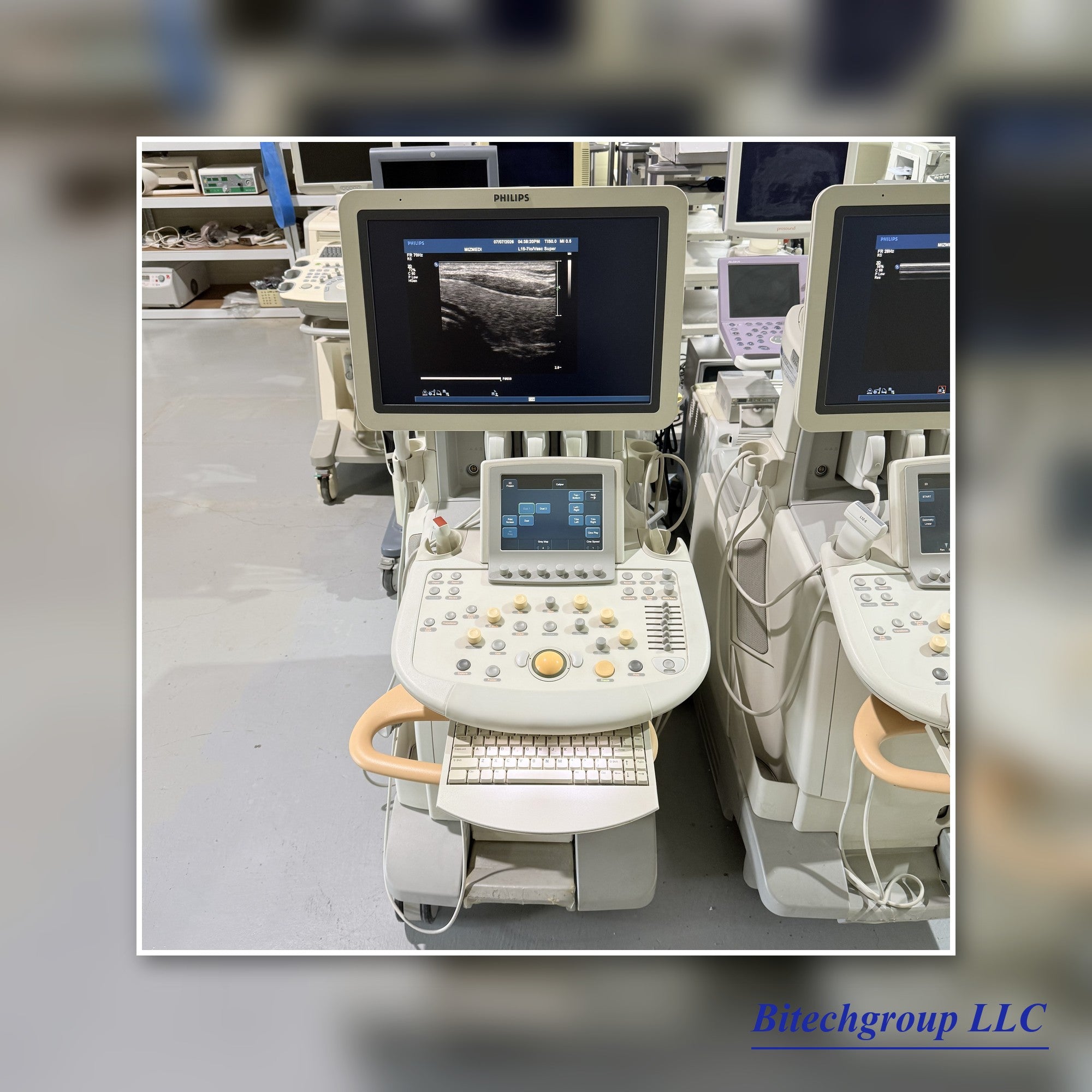 Philips IU22 with Cardiac Linear Hakistick 3 Transducer | Bitech Group