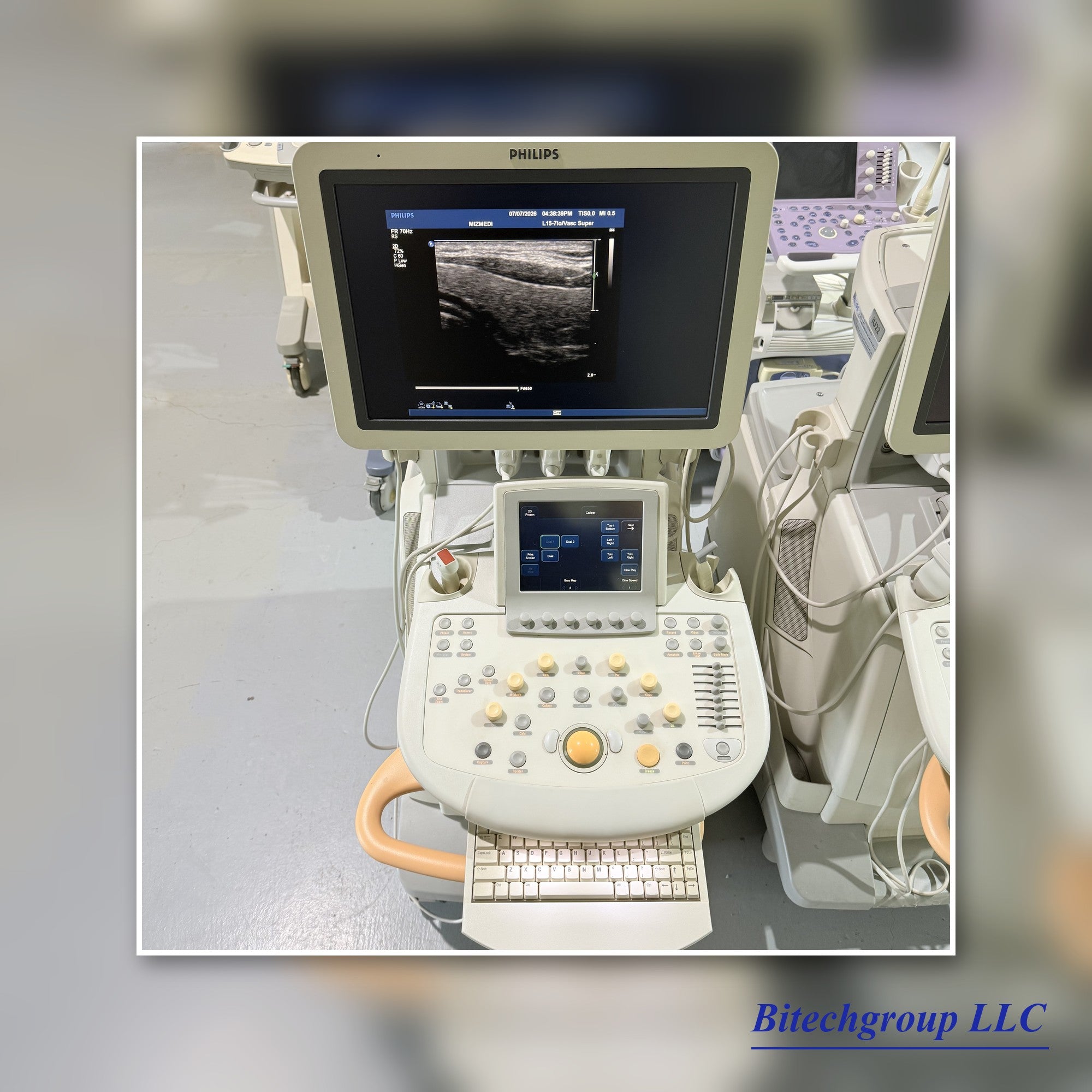 Philips IU22 with Cardiac Linear Hakistick 3 Transducer | Bitech Group