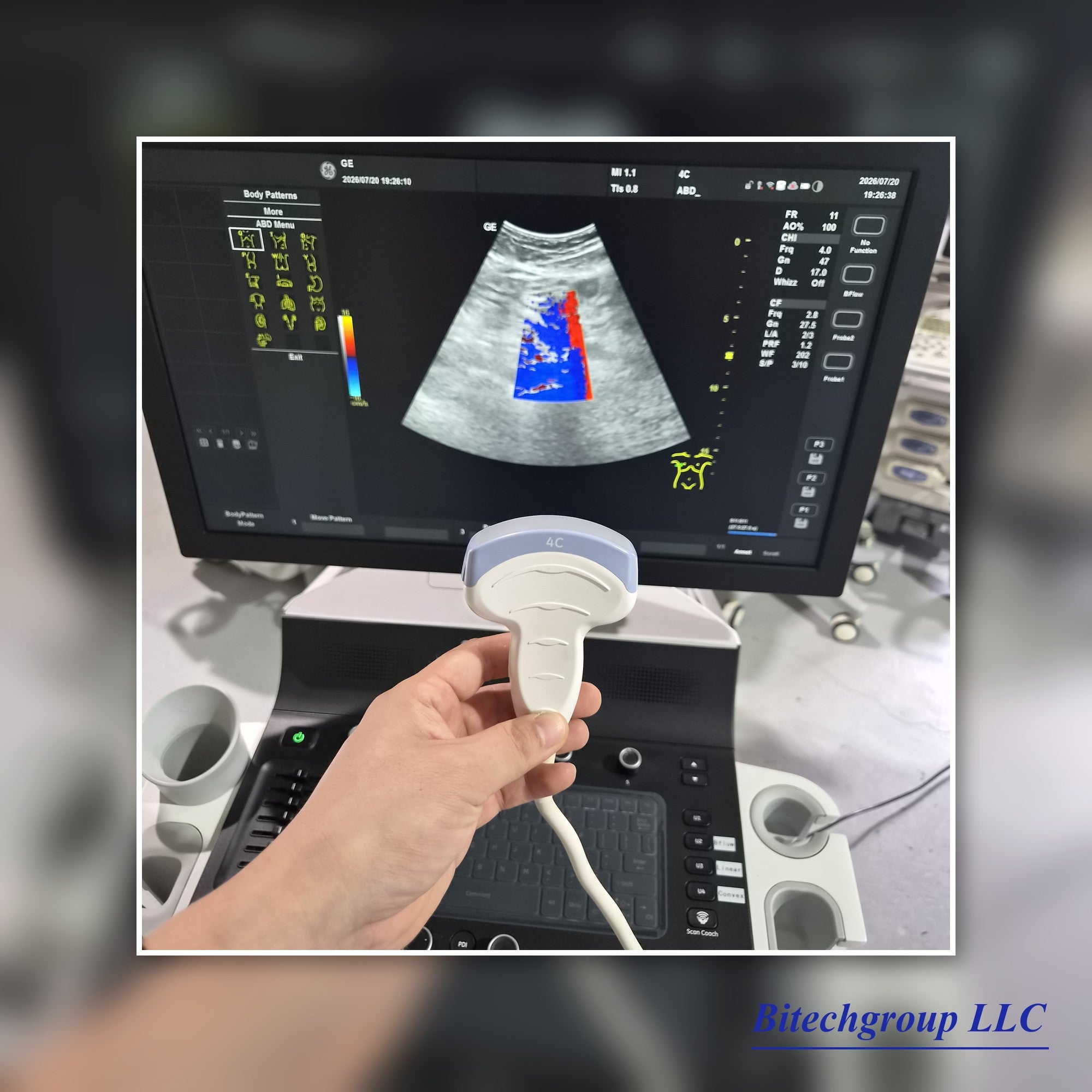 GE Versana 2 Probes System | Bitech Group