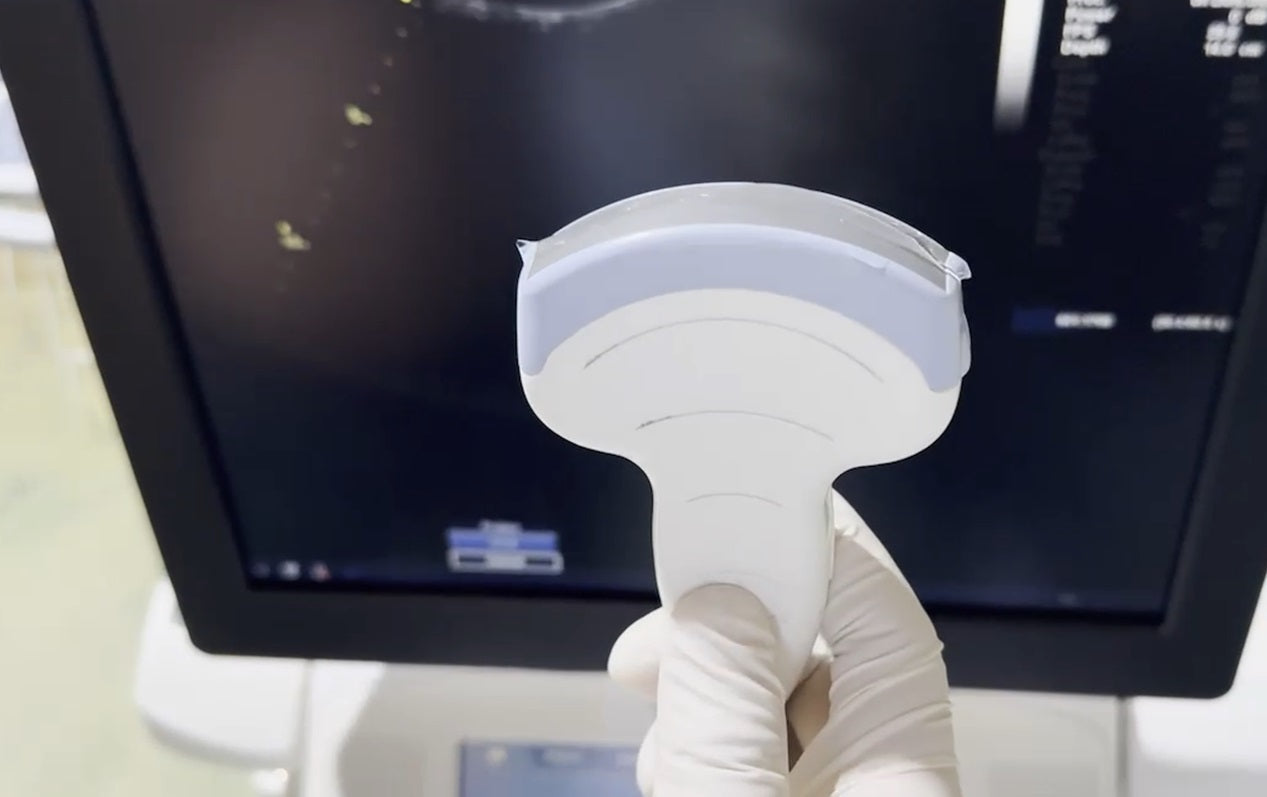 GE Vivid E9 XDclear 4D with 3 Probes